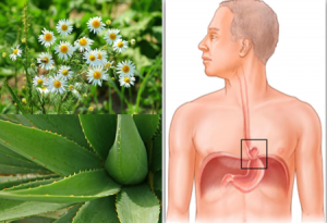 Las plantas medicinales para curar una hernia pueden ser beneficiosas y así ayudar a disminuir el dolor y el ardor. Generalmente hoy hablaremos de las hernias de hiato y como poder aliviarlo de manera natural. Plantas medicinales para curar una hernia