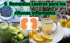 La inflamación y el dolor de los riñones puede afectar mucho a la salud de tu cuerpo. Sin embargo, usar remedios caseros para los riñones inflamados